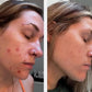 Beef Tallow Face Cream – Moisturizing and Firming Facial Cream for Smooth, Nourished, and Elastic Skin