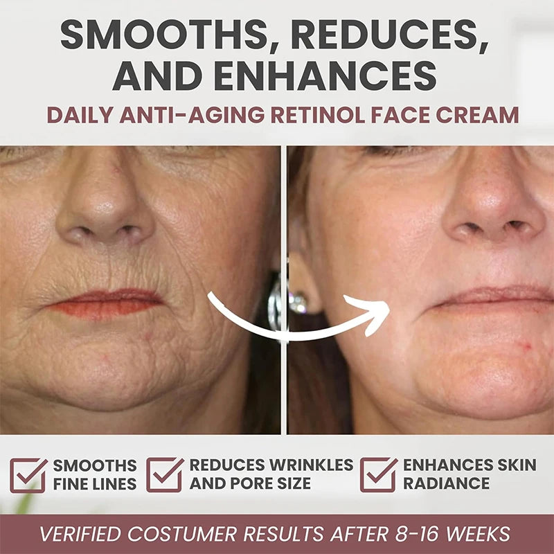 Instant Retinol Cream – Anti-Aging Wrinkle Remover, Firming & Lifting Moisturizer for Fine Lines and Skin Repair