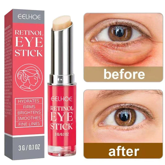 Retinol Eye Cream – Anti-Wrinkle, Dark Circle & Eye Bag Remover, Lifting and Firming Moisturizer