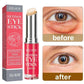 Retinol Eye Cream – Anti-Wrinkle, Dark Circle & Eye Bag Remover, Lifting and Firming Moisturizer