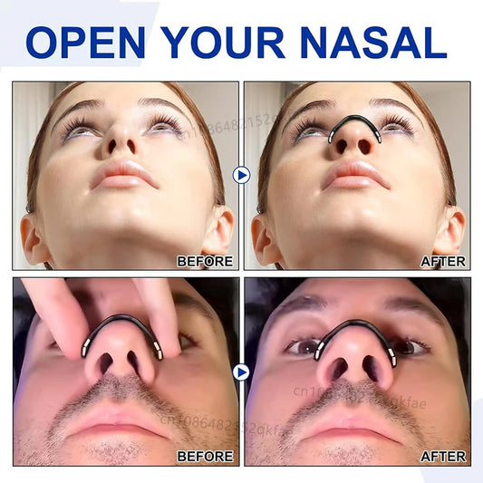 Magnetic Nasal Strips – Skin-Safe Sport Breathing & Anti-Snore Kit