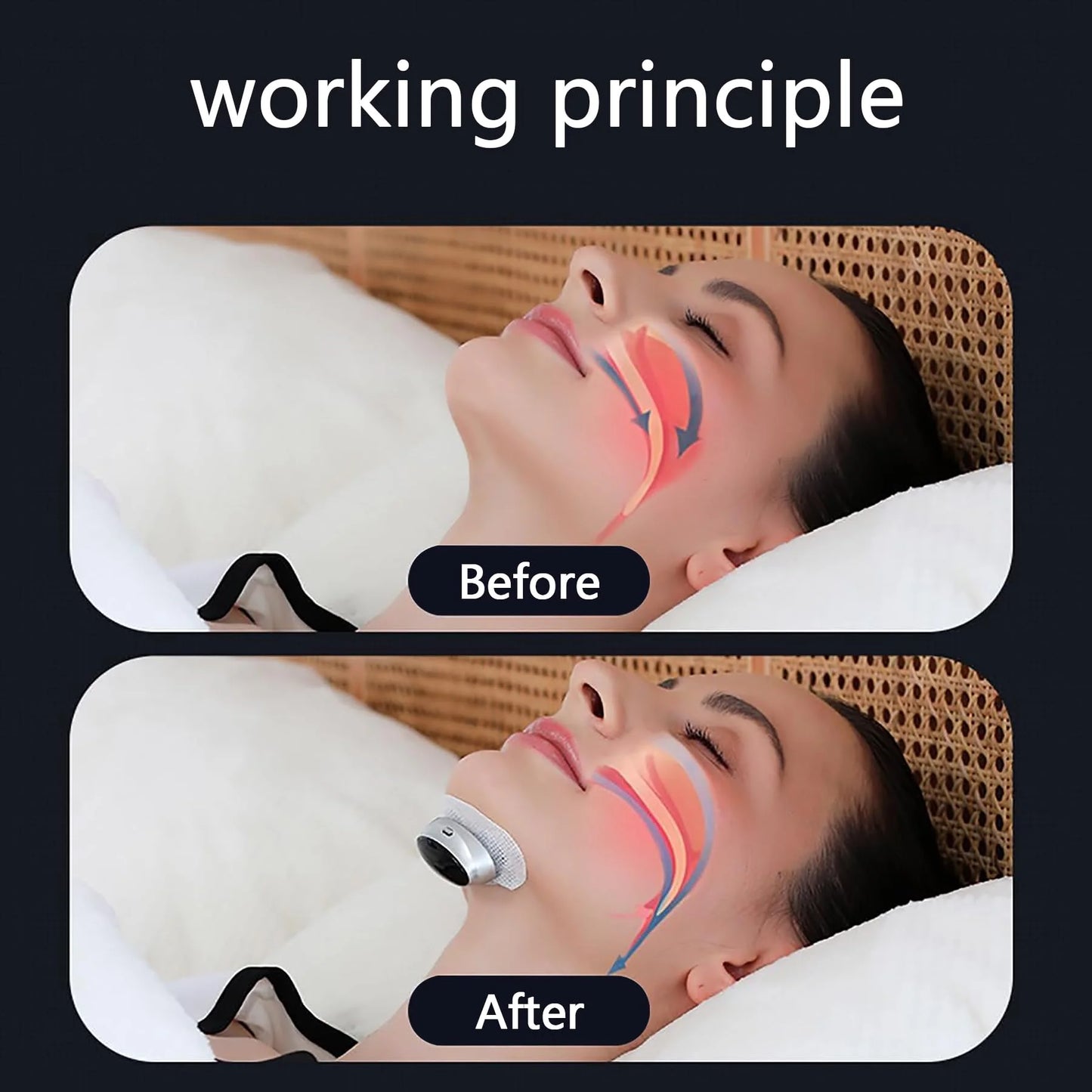 Electric Anti-Snoring Device – Portable Adjustable Sleep Aid