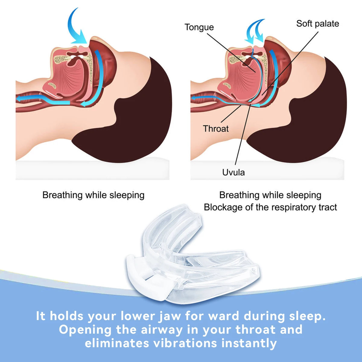 Anti-Snoring Mouth Guard – Stop Grinding & Improve Sleep