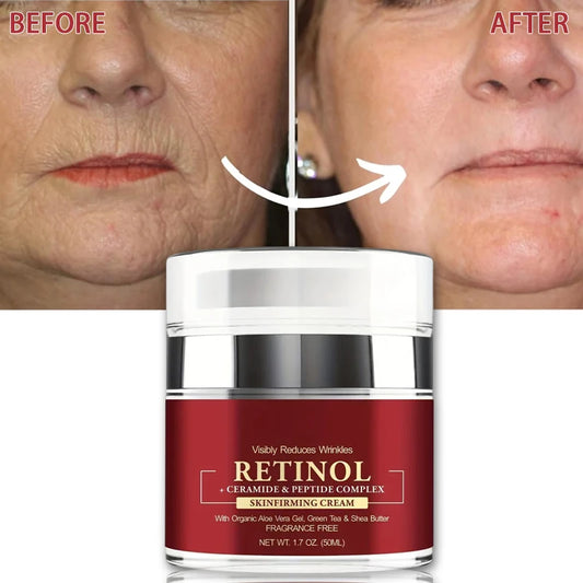 Instant Retinol Cream – Anti-Aging Wrinkle Remover, Firming & Lifting Moisturizer for Fine Lines and Skin Repair