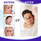 Black Nasal Strips – Extra Strength Anti-Snoring Sleep Aid (30/60/90pcs)