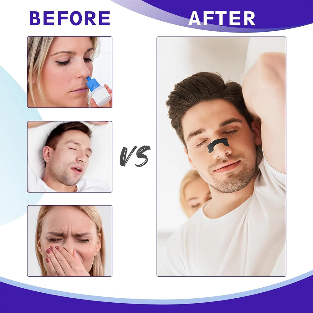 Black Nasal Strips – Extra Strength Anti-Snoring Sleep Aid (30/60/90pcs)