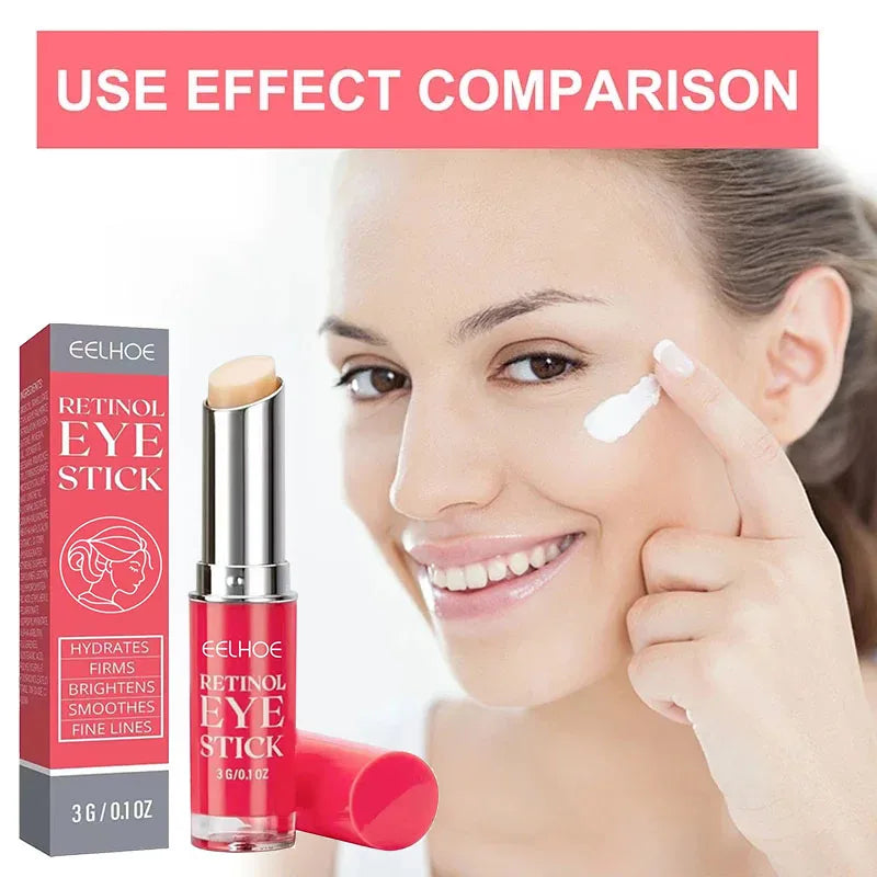 Retinol Eye Cream – Anti-Wrinkle, Dark Circle & Eye Bag Remover, Lifting and Firming Moisturizer