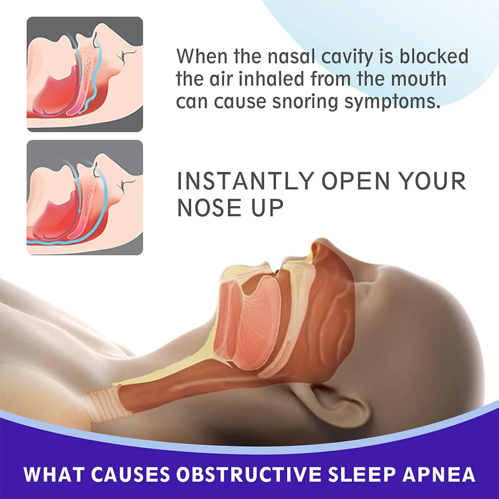 Black Nasal Strips – Extra Strength Anti-Snoring Sleep Aid (30/60/90pcs)