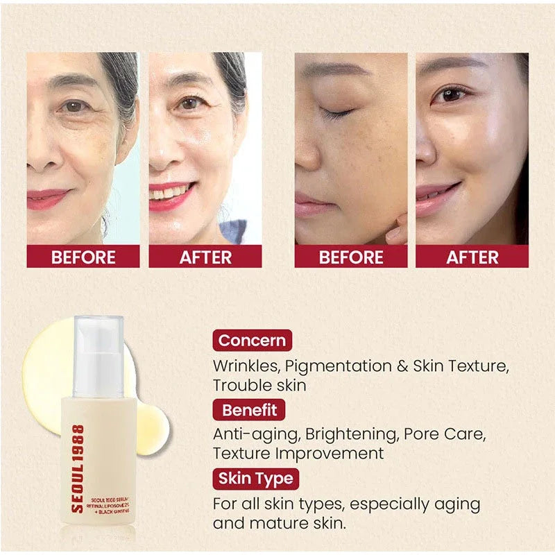 Korean 1988 Retinol Face Serum – Black Ginseng, Niacinamide & Vitamin C Anti-Aging Ampoule for Firming and Wrinkle Care