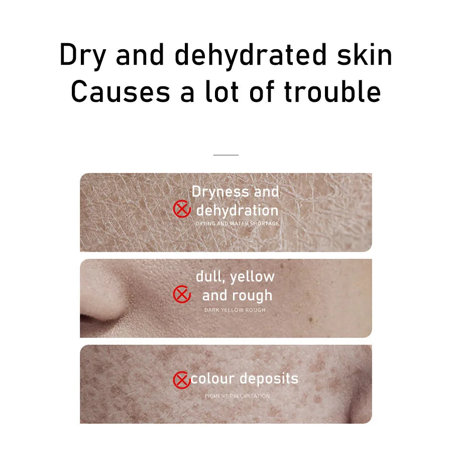 Rice Toner & Cleanser Set – 70% Rice Extract Serum with Niacinamide, Deep Cleansing Foam & Moisturizer for Dry Skin
